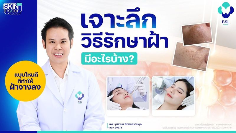 VDO เจาะลึกวิธีรักษาฝ้า มีอะไรบ้าง? แบบไหนดีที่สุด ฝ้าจางลง | Skin insider EP.14