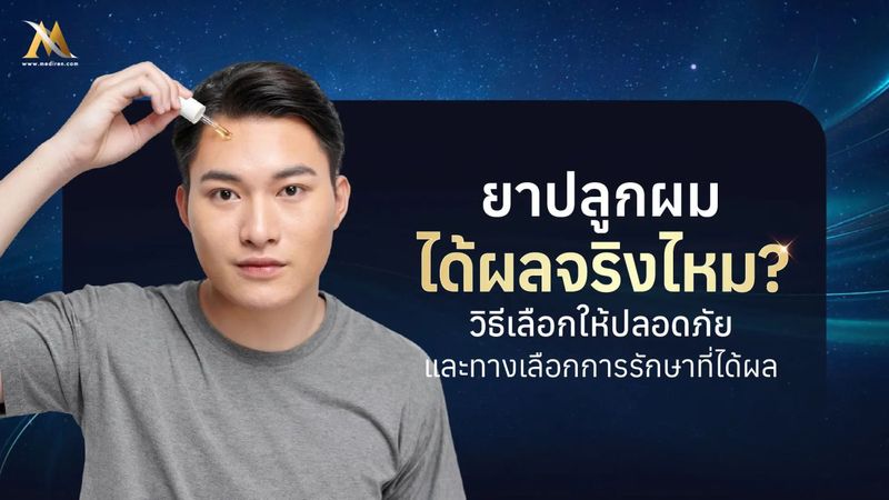 ยาปลูกผม คืออะไร ได้ผลจริงไหม มีข้อควรรู้อะไรก่อนใช้บ้าง?