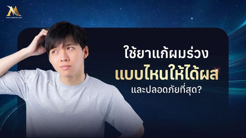 ยาแก้ผมร่วงมีกี่ชนิด ใช้อย่างไรให้ผมหยุดร่วง ไม่ต้องห่วงอันตราย