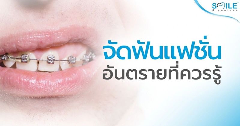 จัดฟันแฟชั่น คืออะไร? อันตรายที่คุณต้องรู้ ก่อนเสียฟันแท้ถาวร