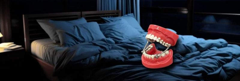 Oral Appliance - ASA - Thaisleep Wellness