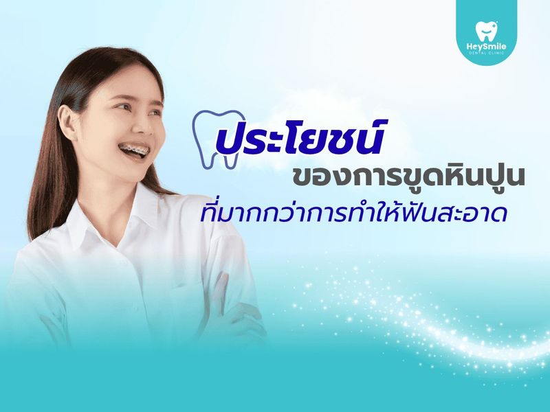 ประโยชน์ของการขูดหินปูน ที่มากกว่าการทำให้ฟันสะอาด - HeySmile Dental Clinic