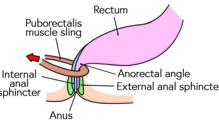 [ณัฐมาคุย] Rectoanal inhibitory reflex : ระบบกันขี้แตก เคยสงสัยกันมั้ย ...