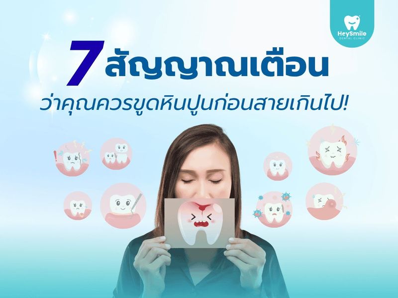 7 สัญญาณเตือนว่าคุณควรขูดหินปูนก่อนสายเกินไป - HeySmile Dental Clinic