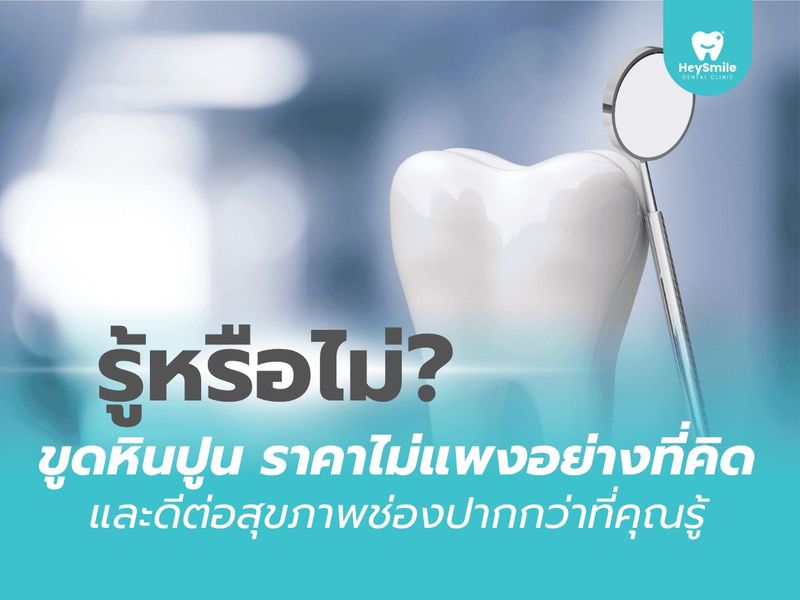 รู้หรือไม่? ขูดหินปูน ราคาไม่แพงอย่างที่คิด และดีต่อสุขภาพช่องปากกว่าที่คุณรู้​ - HeySmile Dental Clinic