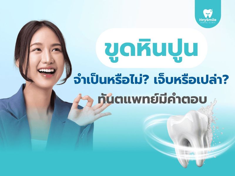 ขูดหินปูนจำเป็นหรือไม่ เจ็บหรือเปล่า? ทันตแพทย์มีคำตอบ​ - HeySmile Dental Clinic