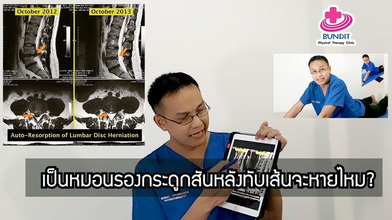 หากเป็นหมอนรองกระดูกทับเส้นประสาท แล้วจะหายได้ไหม? | รักษาให้ตรงจุด Ep.144