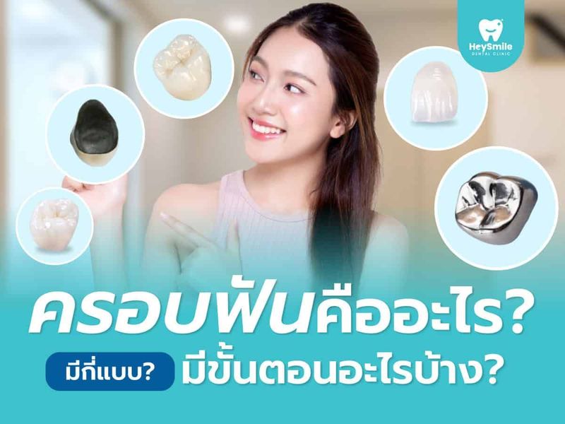 ครอบฟันคืออะไร? ครอบฟันมีกี่แบบ? มีขั้นตอนอะไรบ้าง? - HeySmile Dental Clinic