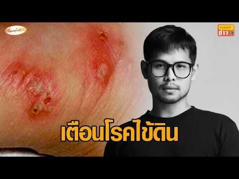 เรื่องเล่าเช้านี้