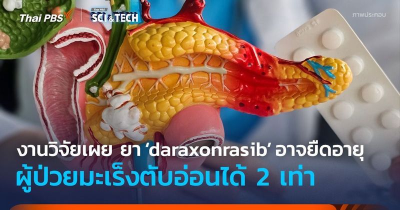 งานวิจัยเผย ยา ‘daraxonrasib’ อาจยืดอายุผู้ป่วยมะเร็งตับอ่อนได้ 2 เท่า | Thai PBS NOW