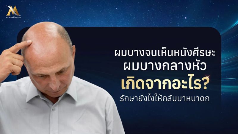 ผมบาง สาเหตุเกิดจากอะไร มีวิธีป้องกันและรักษาอย่างไร?