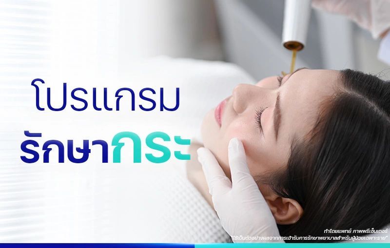 รักษากระ ให้ผิวดูกระจ่างใสขึ้น ด้วยการรักษาตามสาเหตุ จาก BSL