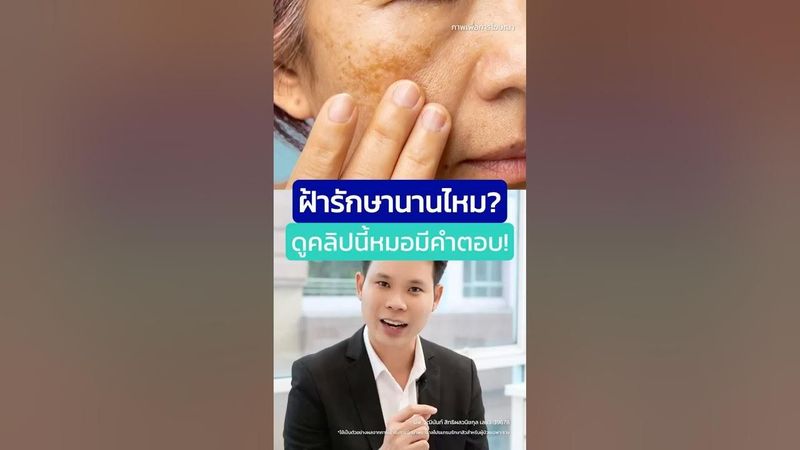 ฝ้าแบบไหนรักษานานที่สุด? หมอตอบจากประสบการณ์จริง