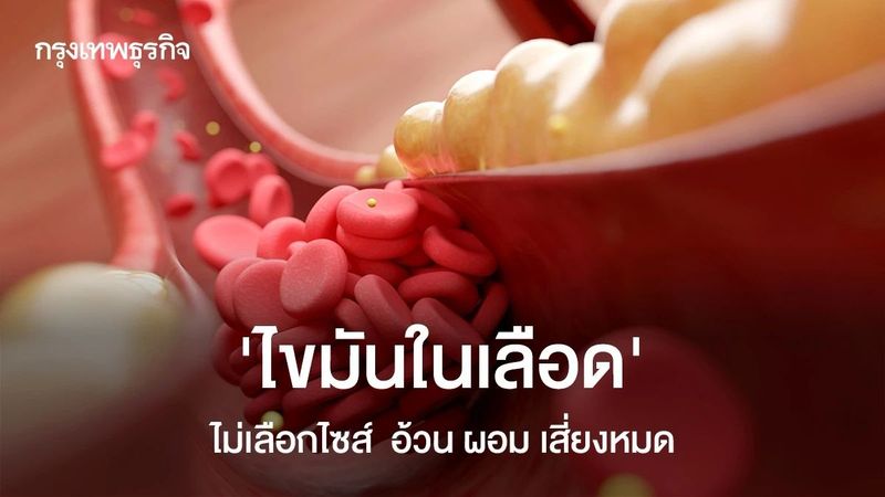 ‘ไขมันในเลือด’ไม่เลือกไซส์ ผอม-อ้วน เสี่ยงหมด แนะเช็ก ‘CT Calcium Score’