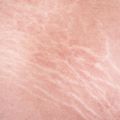 Linery Wellness Center ( Hair & Skin Transformation Bangkok)